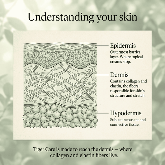 Tiger Care Stretch Mark Serum