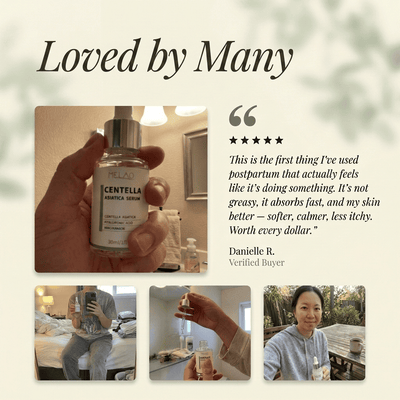 Tiger Care Stretch Mark Serum